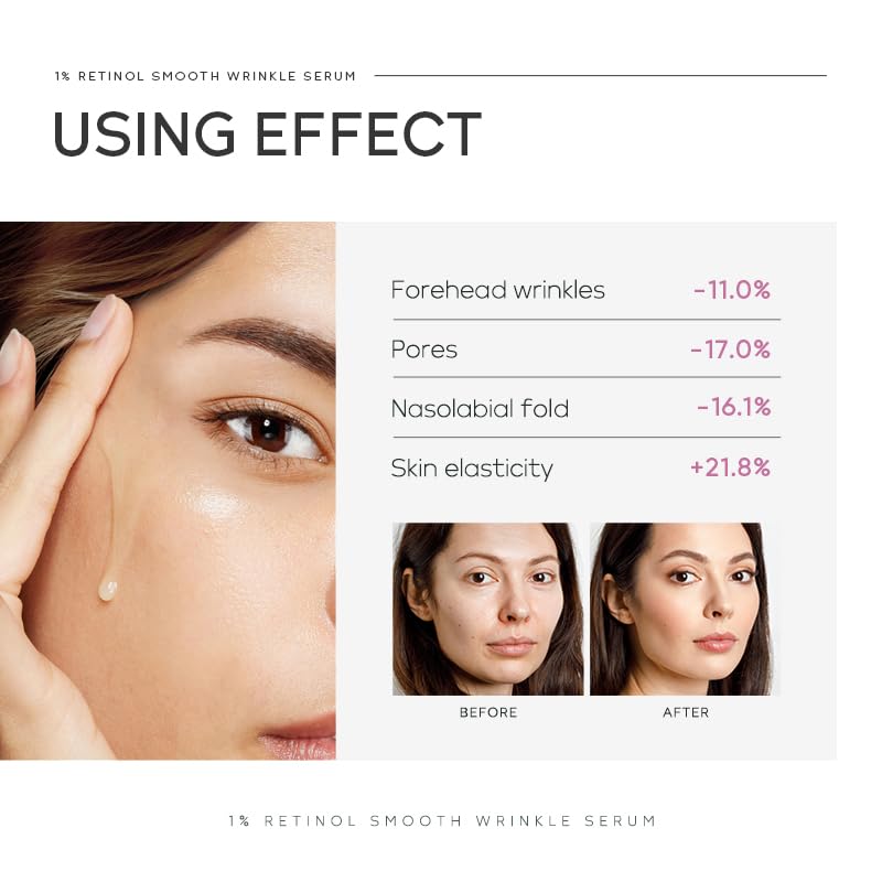 Anti Aging Skin Care Set, 1% Retinol Dark Spot Remover for Face with Face Serum & Moisturizer, Travel Size Skincare Set for Women, Reduce Wrinkles, Firm & Hydrate for All Skin Types