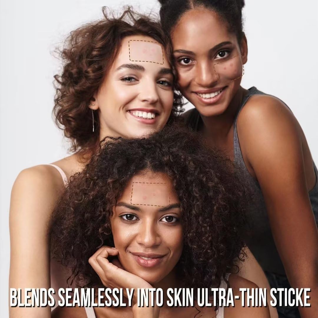 AUSLKA Large Blemish Zit Patches XL - 20 Strips - Hydrocolloid Dots -Blemishes Patch - Zit Breakouts - Blemishes Stickers - Max Size