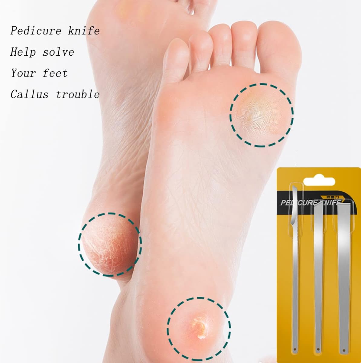 3PCS Stainless Steel ingrown toenail Pedicure Knife Set, Professional Foot Skin Scraper Repair Sharp Blade kit for Nail Corn Callus Paronychia Treatment (with Holes)