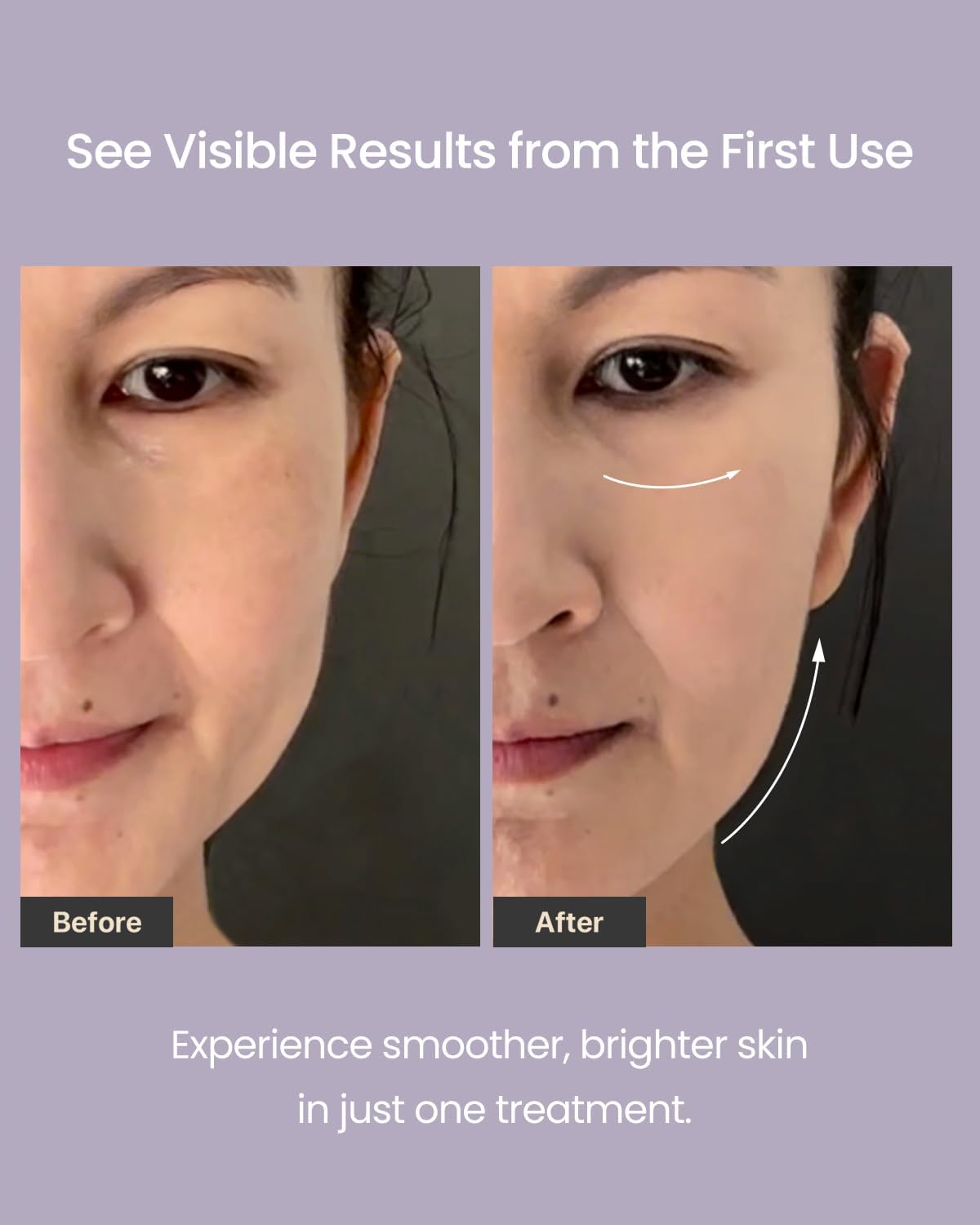 AMIRO R3 Turbo Facial Device, Precision Firming and Fine Line Smoothing Tool for Full Face, Eye Area & Jawline at-Home Therapy Purple