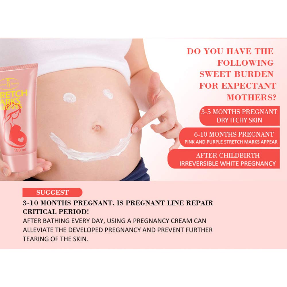 AICHUN BEAUTY Pregnancy Cream Streach Mark Remover Scars Repair Cellulites Lotion Cream 150ml