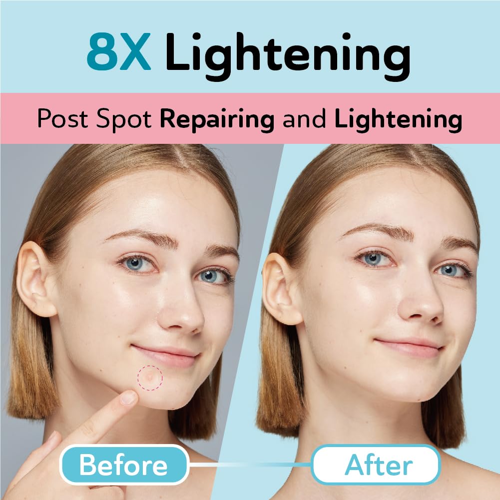 Dark Spot Patches Blemish Patches with Hydrocolloid, TXA & CICA for Active Acne & Post-Inflammatory Dark Spots - Day and Night Use - UPGRADED (Post Acne - 132 Count - 2 Size)