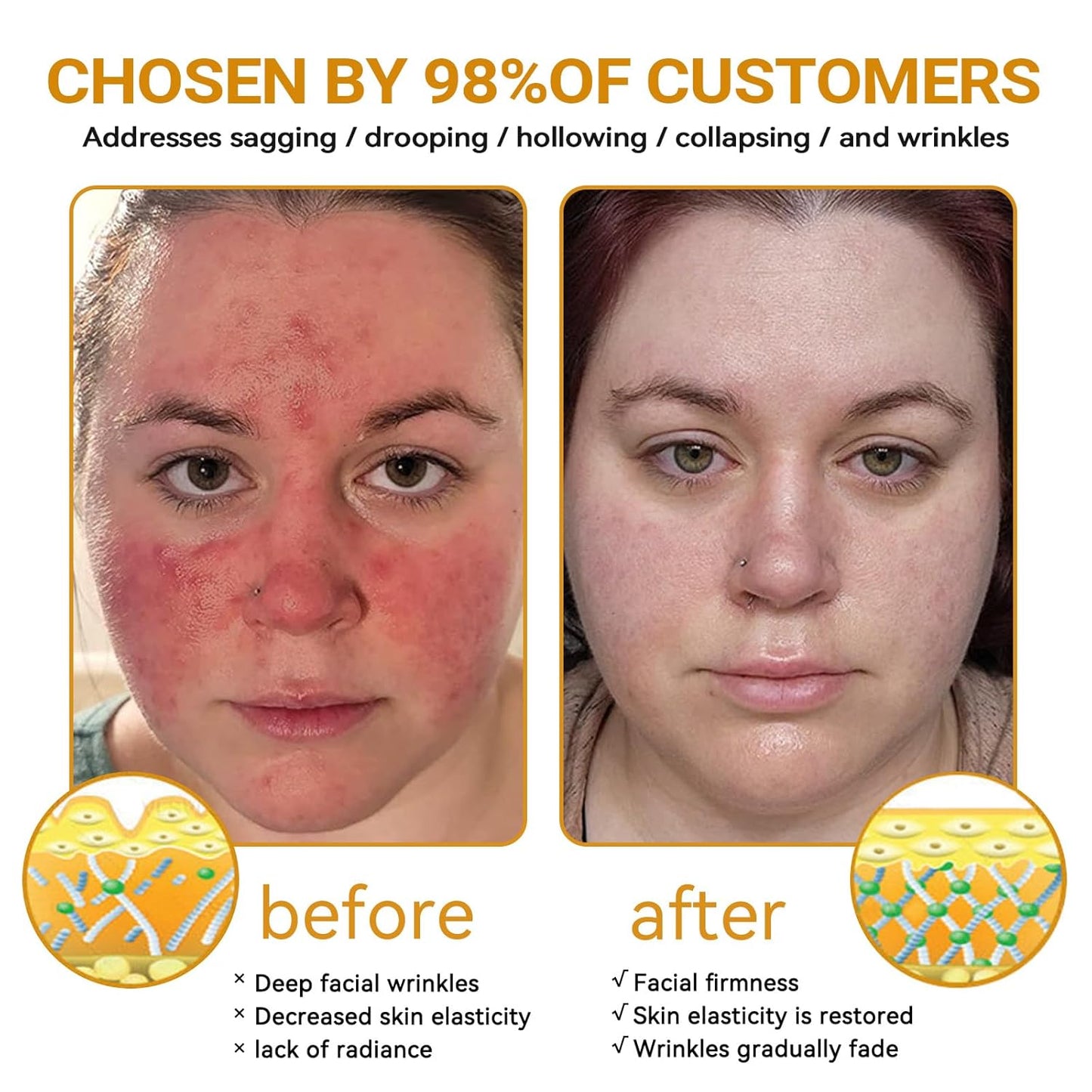 LipMaps Bee Venom Skin Restoration Cream, Bee Venom Skin Treatment Cream, Repair skin and Firming, Effective In Reducing Blemishes (2)