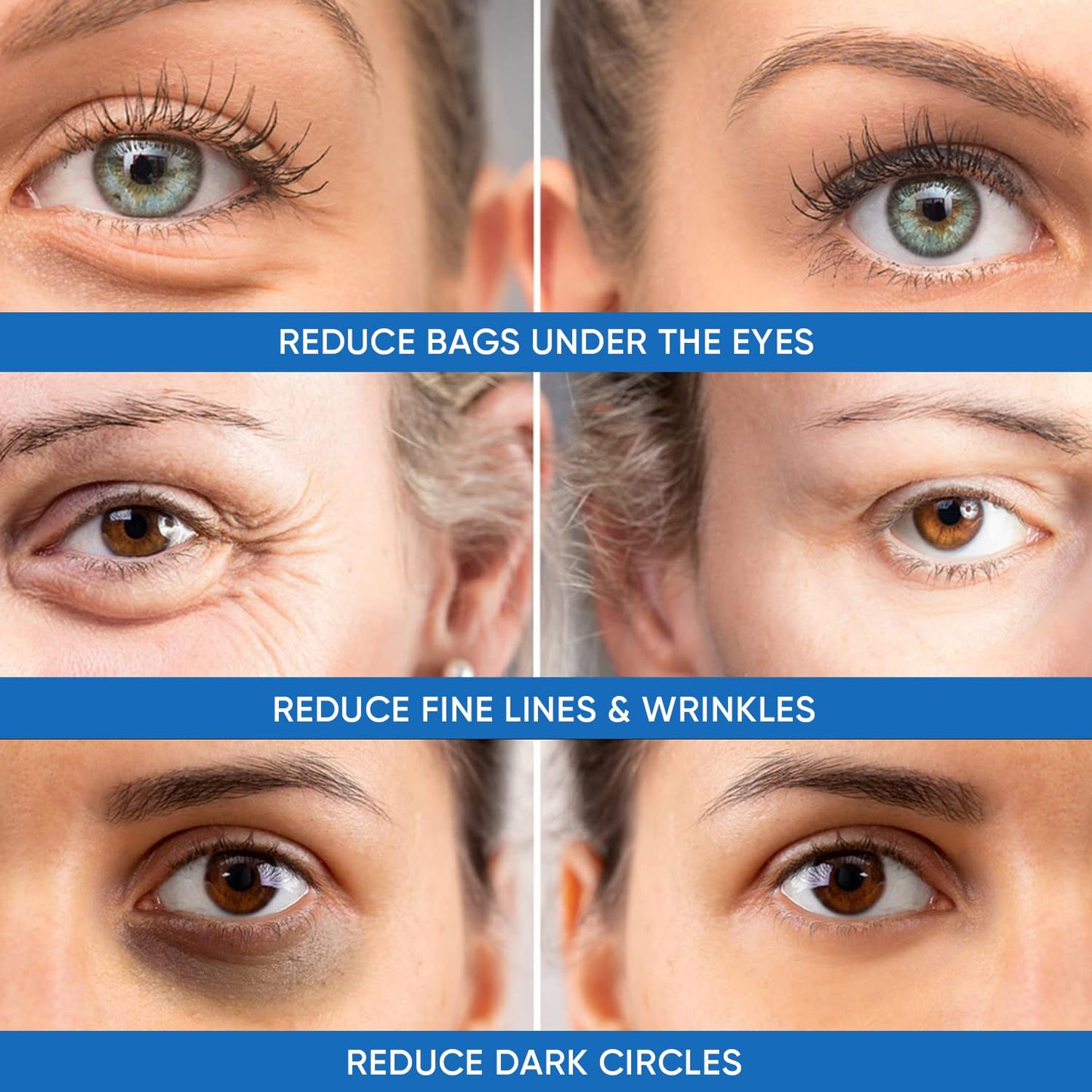 Under Eye Puffiness & Dark Circles Rapid Treatment- Instantly Reduces the Appearance of Puffy Eye Bags, Crow’s Feet, & Sagging Skin.