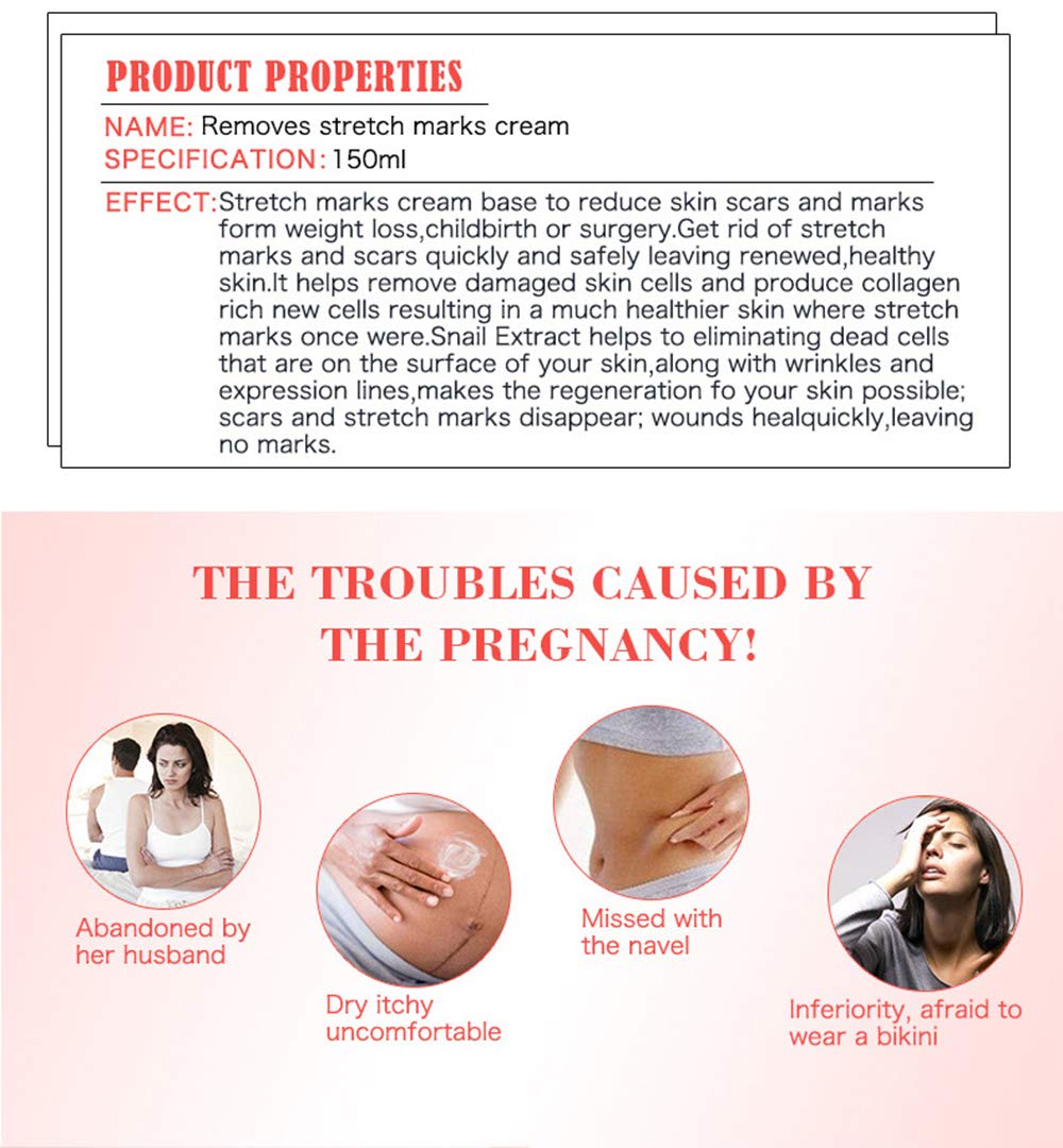 AICHUN BEAUTY Pregnancy Cream Streach Mark Remover Scars Repair Cellulites Lotion Cream 150ml