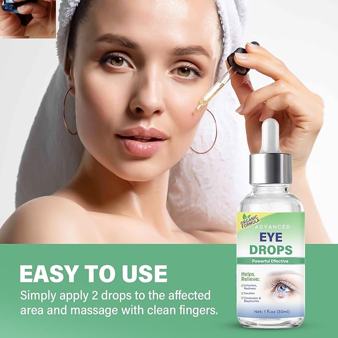 Stye Eye Treatment, Stye Eye Drops Serum for Styes Chalazion and Blepharitis, Chalazion Remover Fast Relief, Restore Healthier Eye Skin, 30ml