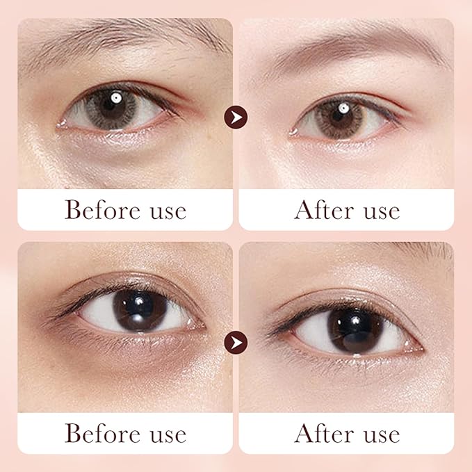 Retinol Eye Cream Stick for Dark Circles Under Eye Treatment, Puffiness and Bags - Firming & Hydrating Eye Cream for Anti-Aging Results in 3-4 Weeks