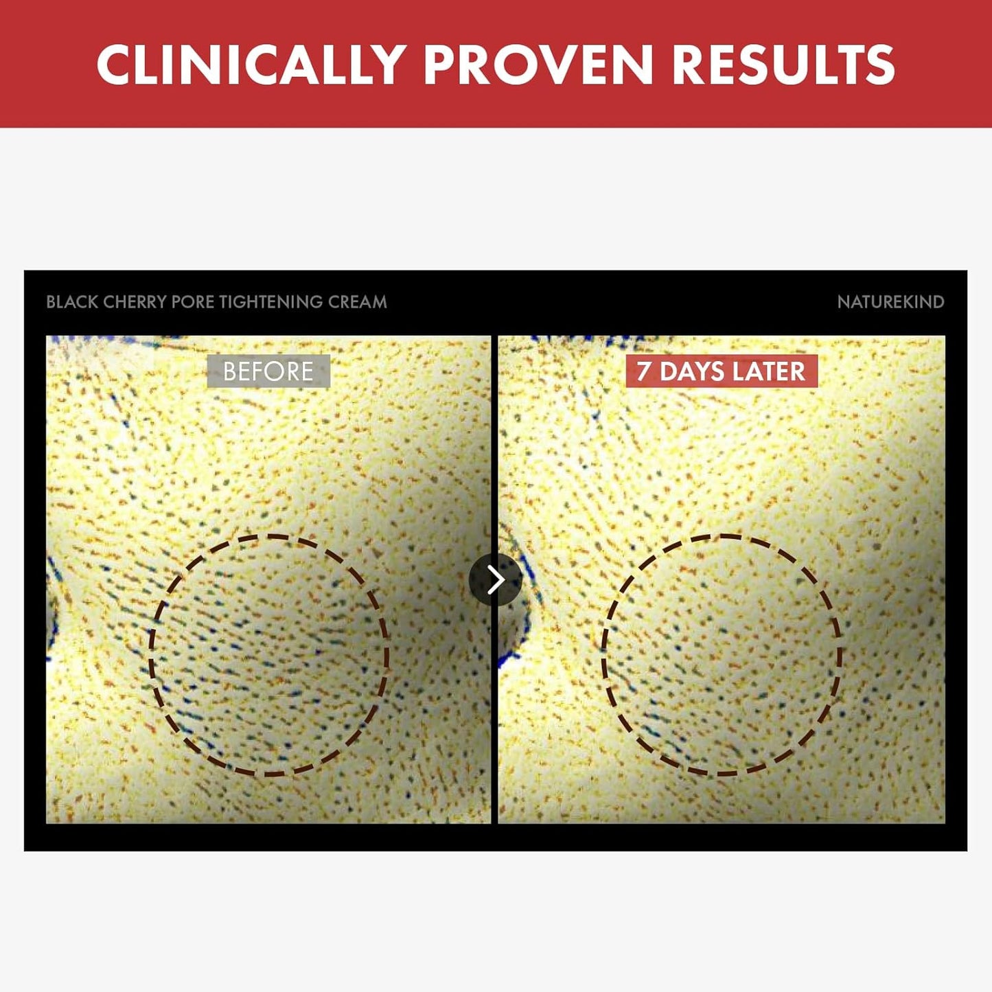 Black Cherry Pore Tightening Cream, Minimize Enlarged Pores with a soft texture, Face Cream, Korean Skin Care Product 100ml, 3.38 fl. oz.