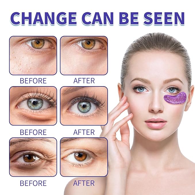 Under Eye Patches (28 Pairs), Eye Mask for Dark Circles, Puffy Eyes, Eye Bags, Wrinkles, 7 Colors Crystal Gel Gold Eye Mask Patches, Eye & Lip Treatment Skin Care Products