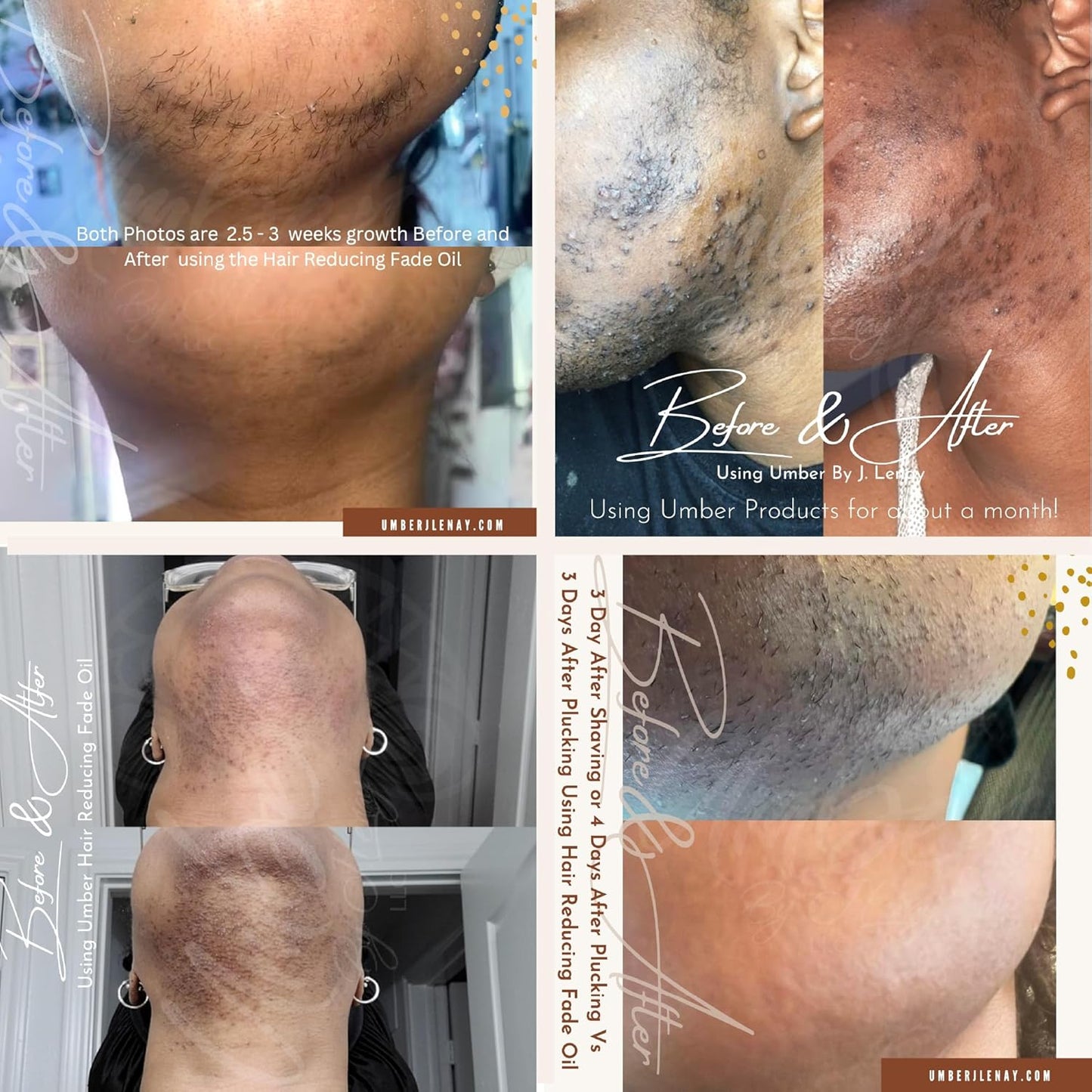 Hair Reducing Fade Oil – Regular Strength (Not sensitive skin), Minimizes Hair Growth for Face & Body – For Women & Men – 15ml Serum