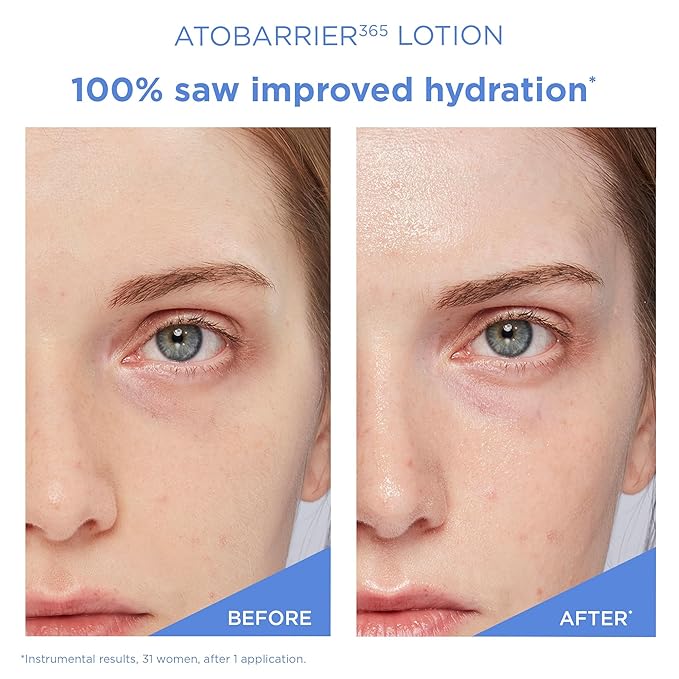 AESTURA ATOBARRIER365 Lightweight Cream + Facial Mist