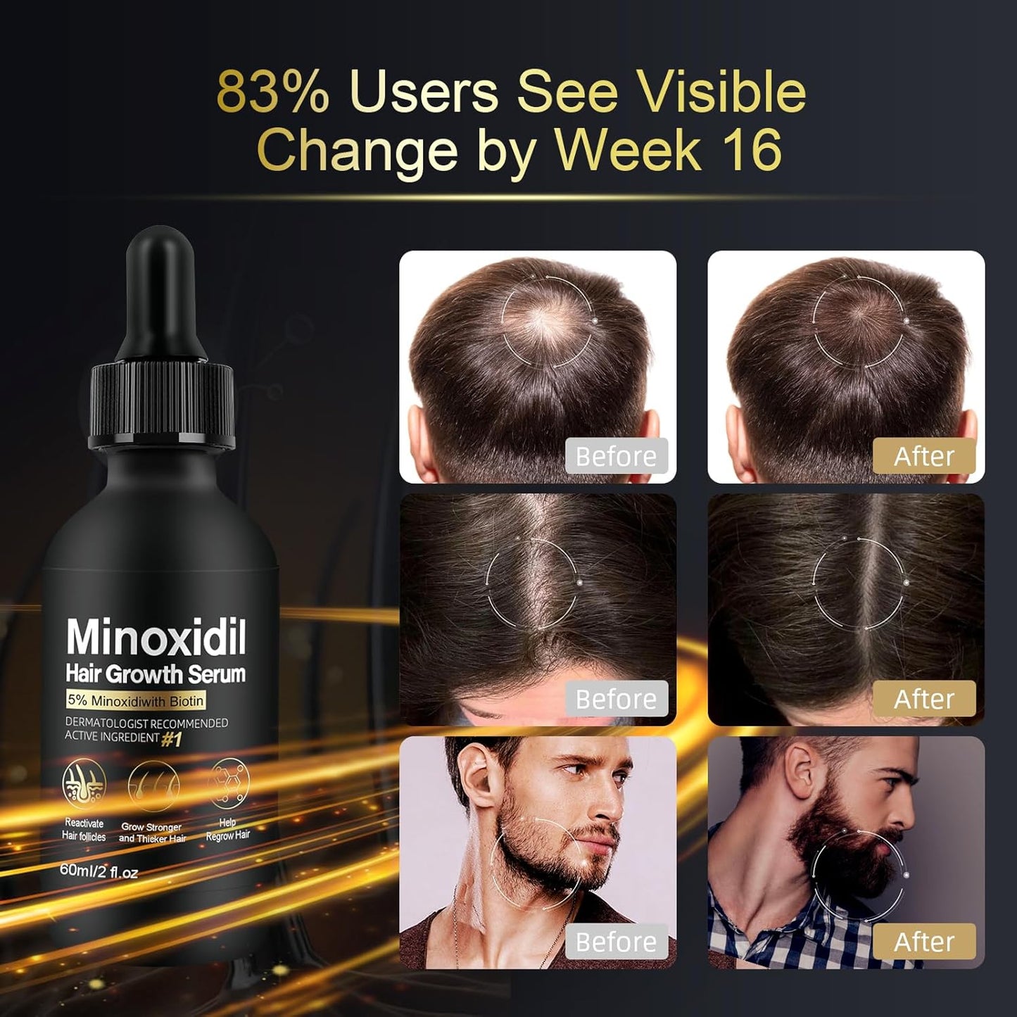 5% Minoxidil for Women Hair Growth - Hair Regrowth Treatment for Men and Women - Minoxidil Hair Growth Serum for Fuller, Thicker Hair